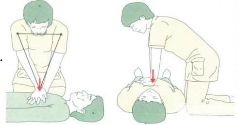 胸外按压视频,关键时刻的生命守护术