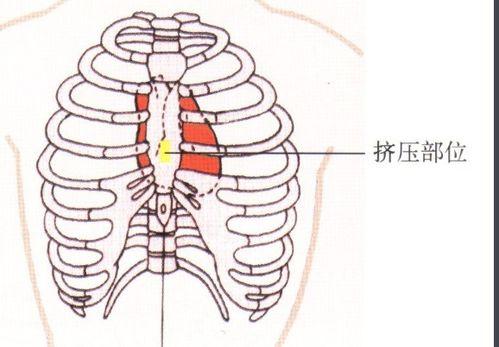 胸外按压视频,关键时刻的生命守护术
