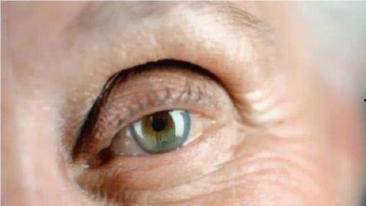 做双眼皮的视频,视频教学带你变身电眼女神