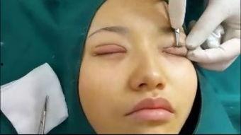 做双眼皮的视频,视频教学带你变身电眼女神