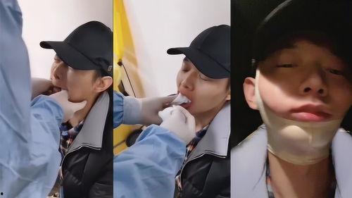 下巴脱臼视频,视频详解应对方法