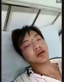 帅哥受伤视频,视频记录惊险瞬间